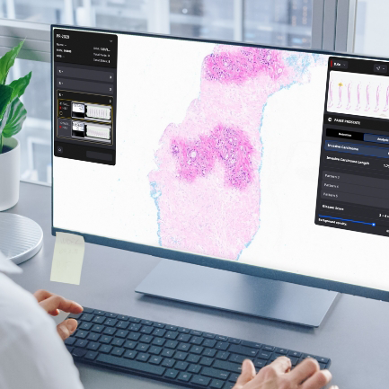medical diagnostics